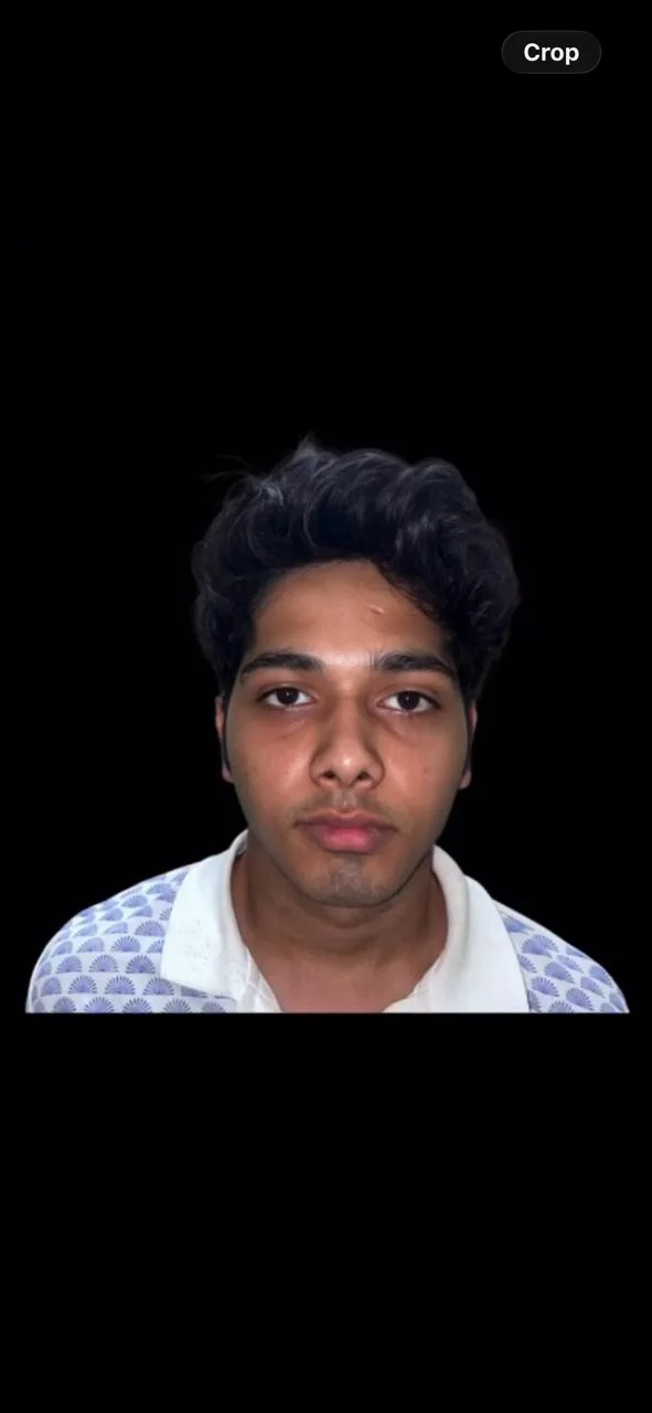 After Treatment Result - Facial Profile & Chin Alignment Realignment at Dentafusion Kota