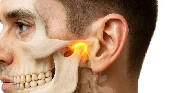 TMJ & Jaw Pain Therapy in Kota - Dentafusion Dental Clinic